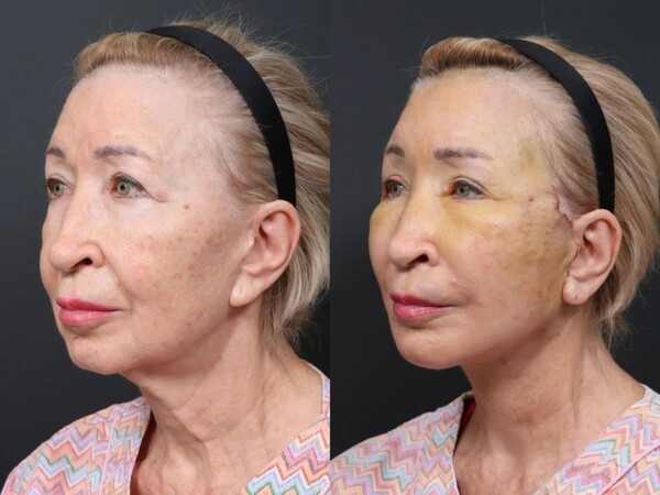 호수뉴스 이미지