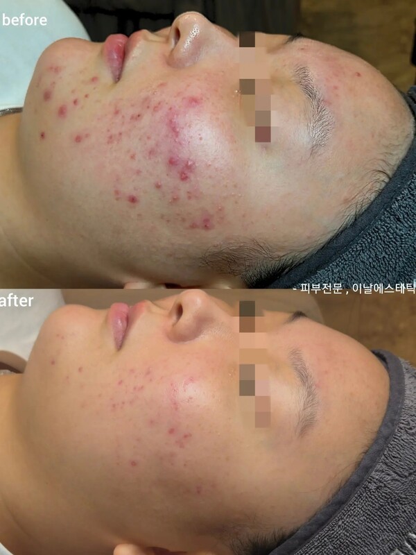 호수뉴스 이미지
